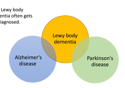 lewy body dementia